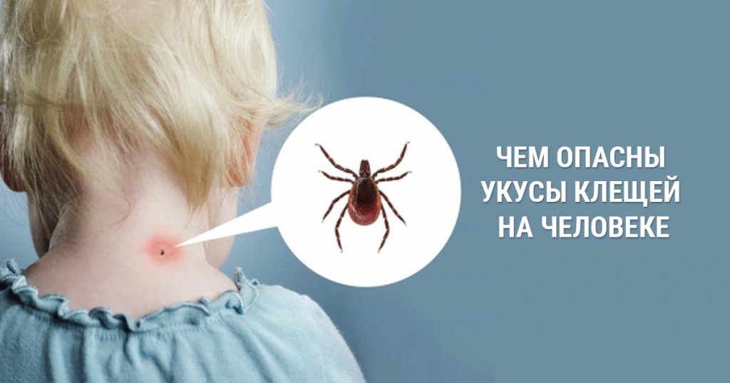 Опасность клещей